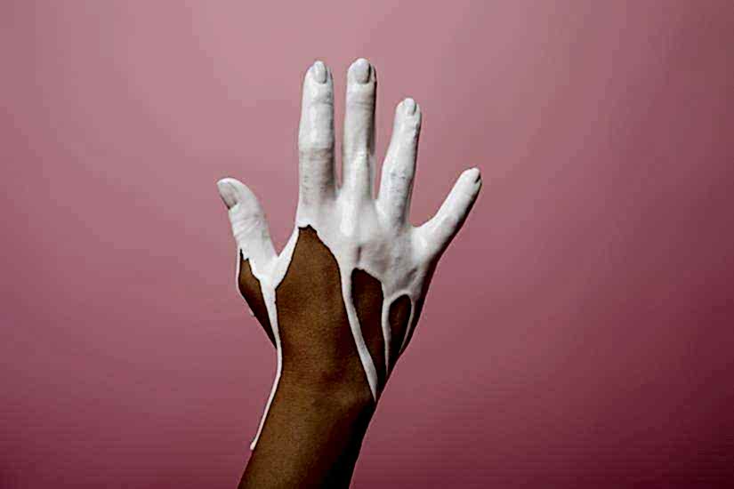 Silikon Elden Nasıl Çıkar?